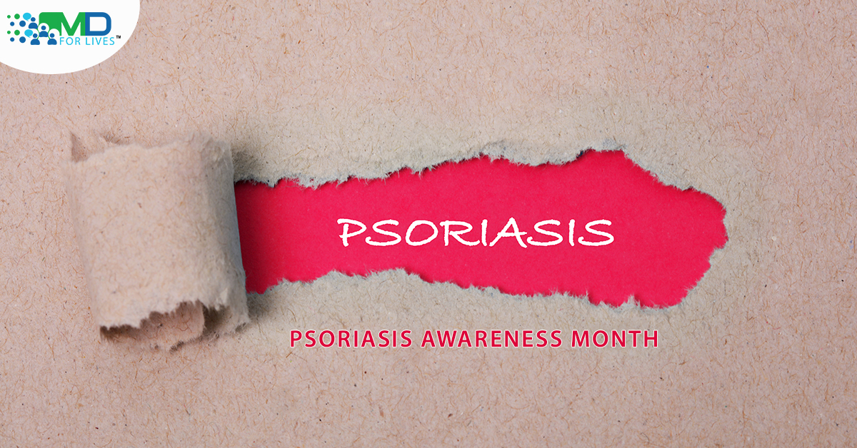 Psoriasis