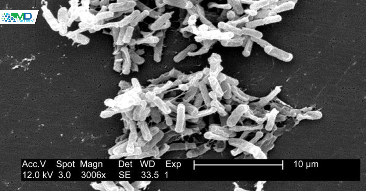 Clostridioides difficile infection