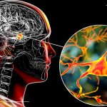 Autism & Amygdala overgrowth