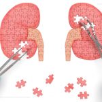 Decision making pathways around Nephron Sparing Renal Surgery