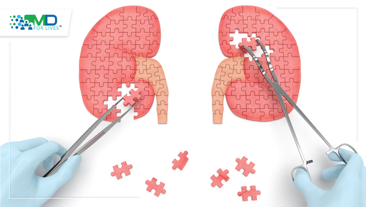 Decision making pathways around Nephron Sparing Renal Surgery