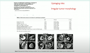 Decision making pathways around Nephron-Sparing Renal Surgery