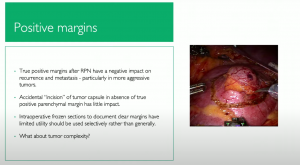 Decision making pathways around Nephron-Sparing Renal Surgery