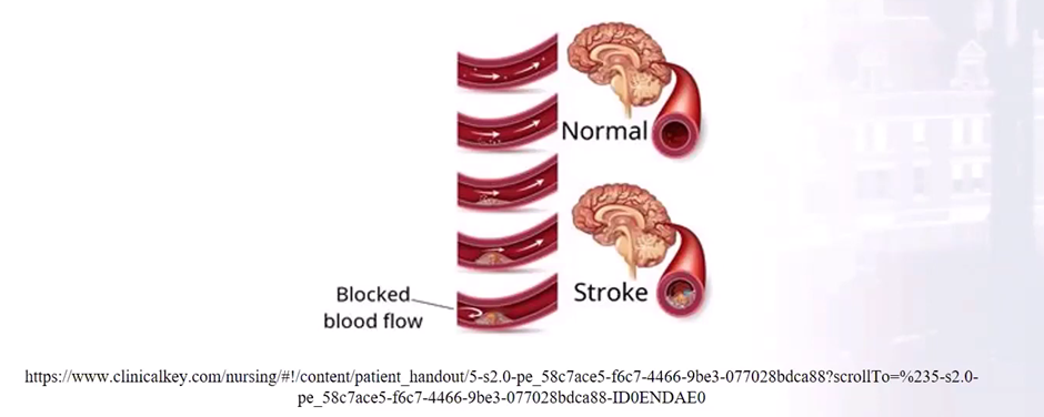 blocked blood flow