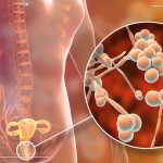 New research unlocks the evolutionary mystery of Candida auris