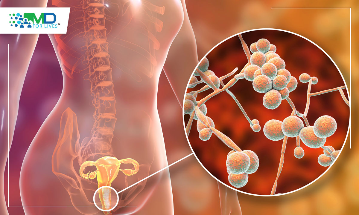 New research unlocks the evolutionary mystery of Candida auris