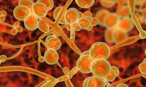 New research unlocks the evolutionary mystery of Candida auris