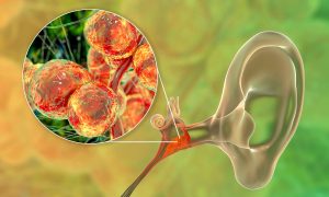 New research unlocks the evolutionary mystery of Candida auris