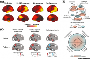Decoding the Subtypes of Alzheimer's Disease