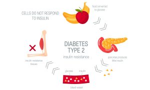 Tirzepatide, a recently approved drug, targets two receptors to fight diabetes