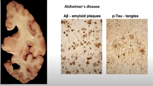 How stem cells can help us in the future?