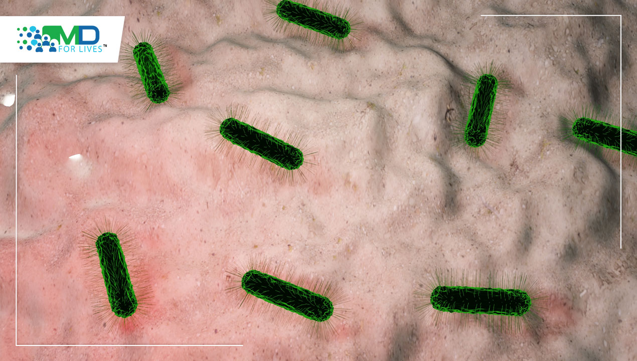 Typhoid -causing bacteria are resistant to most of the popular drugs