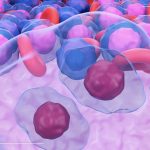 Hodgkin’s lymphoma trial shows overall survival benefits from the newer regimen