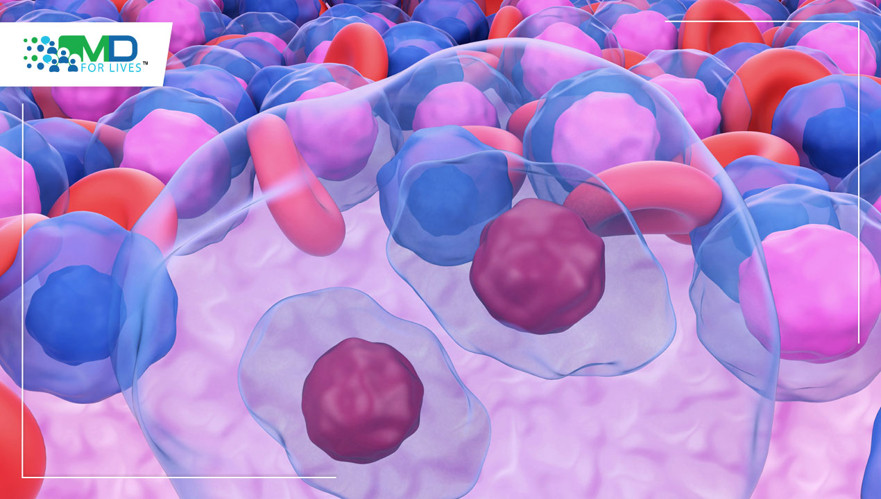 Hodgkin’s lymphoma trial shows overall survival benefits from the newer regimen