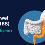 Irritable bowel syndrome