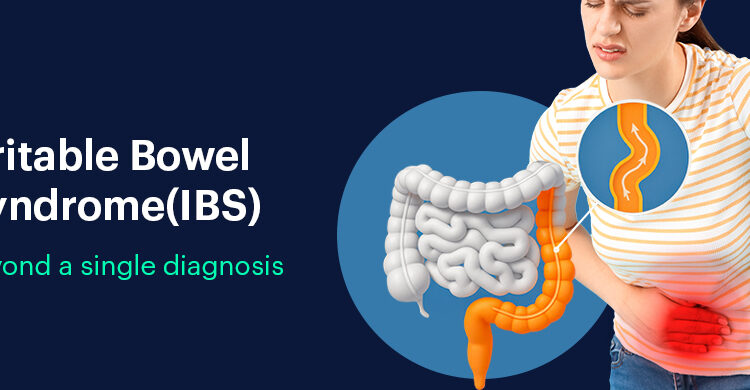 Irritable bowel syndrome
