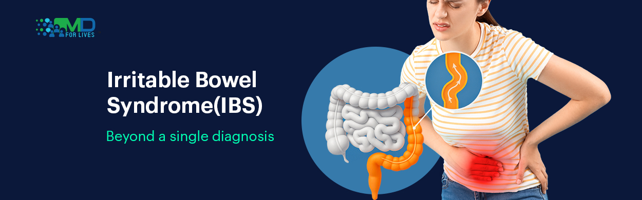 Irritable bowel syndrome