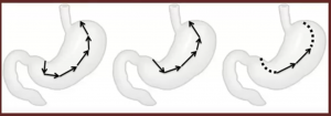 anastomosis