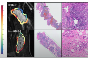 associated lymphocyte density
