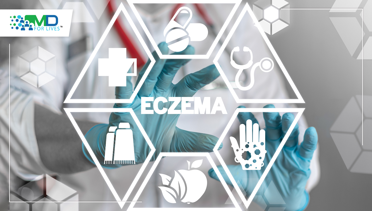 A novel treatment for mild to severe Atopic Dermatitis