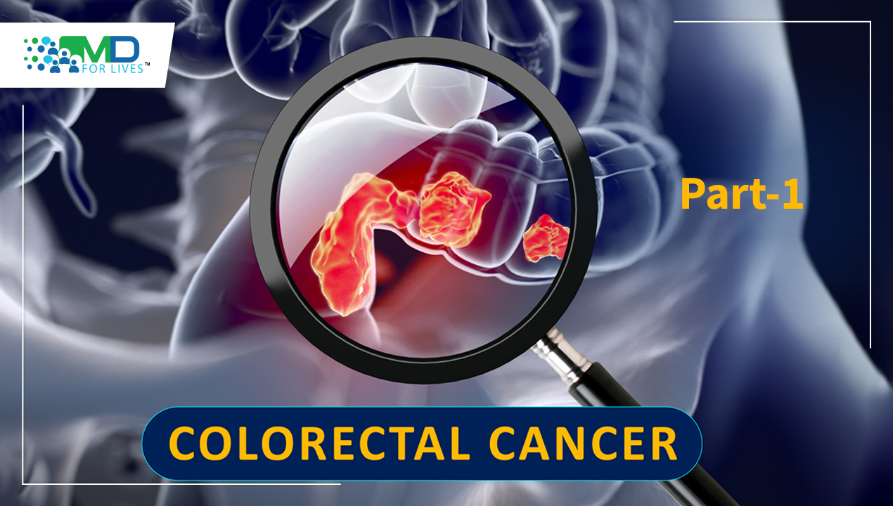 New paradigms in Colorectal Cancer – Part 1
