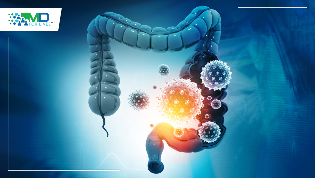 Bowel Cancer