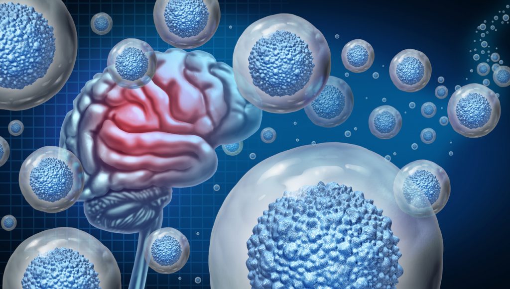 Stem cell therapy