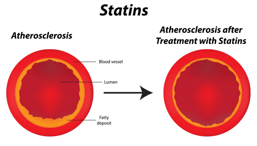 The first statin