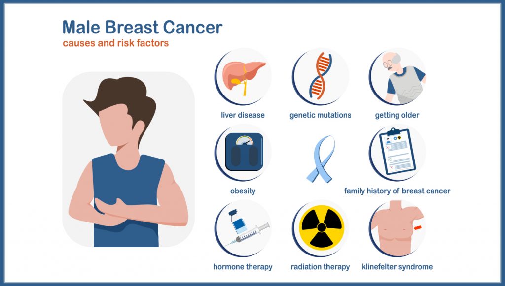Breast Cancer In Men