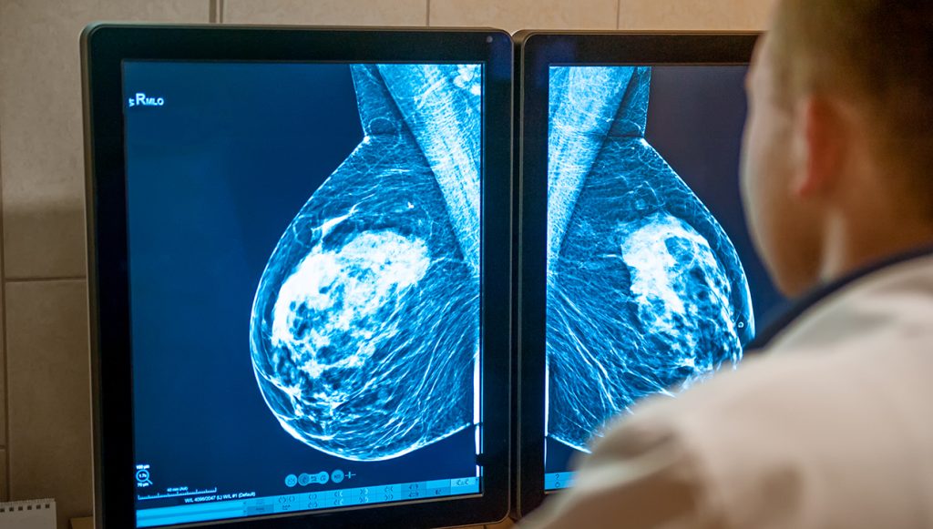 cancer patients' experience