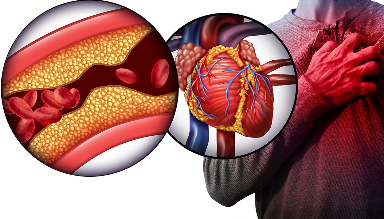 knowledge gaps in cardiovascular care