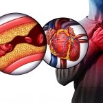 knowledge gaps in cardiovascular care
