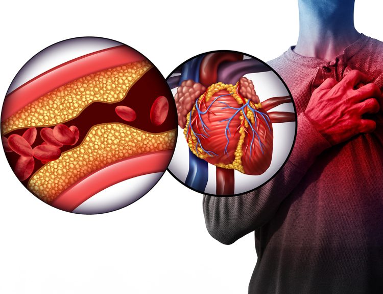 knowledge gaps in cardiovascular care