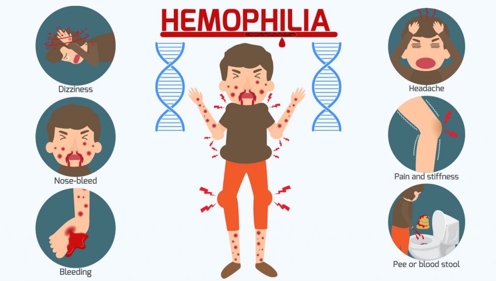 Christmas Disease Symptoms