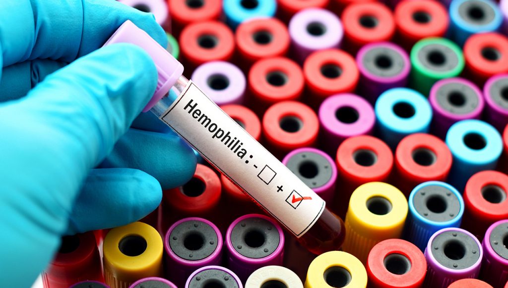 social effects of Haemophilia B