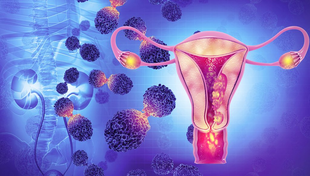 prevent cervical cancer