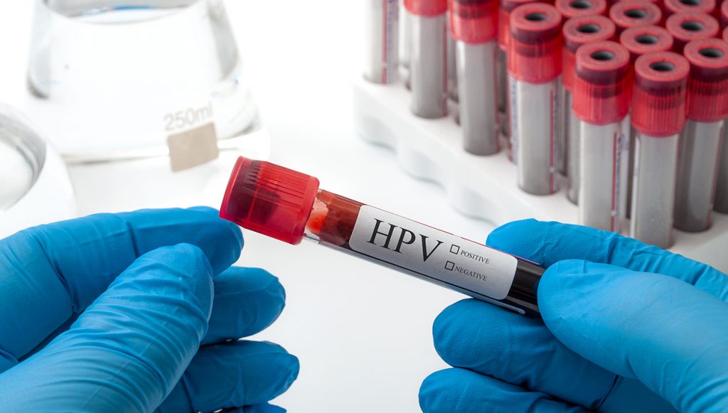 HPV testing