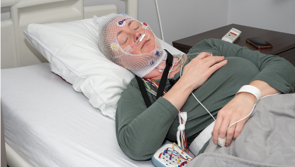 Sleep Disorders and Epilepsy