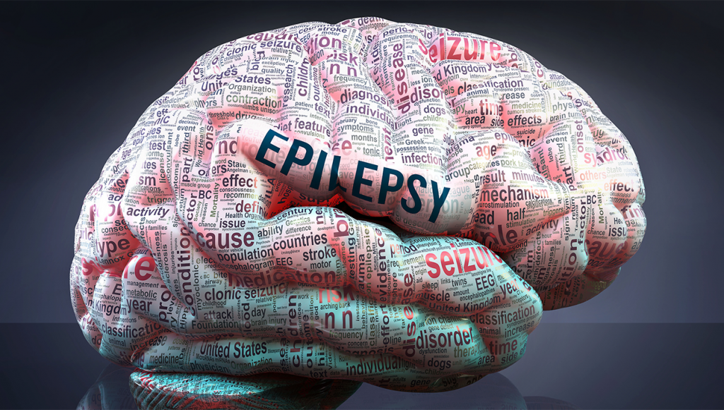 sleep and epilepsy