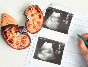 Renal imaging