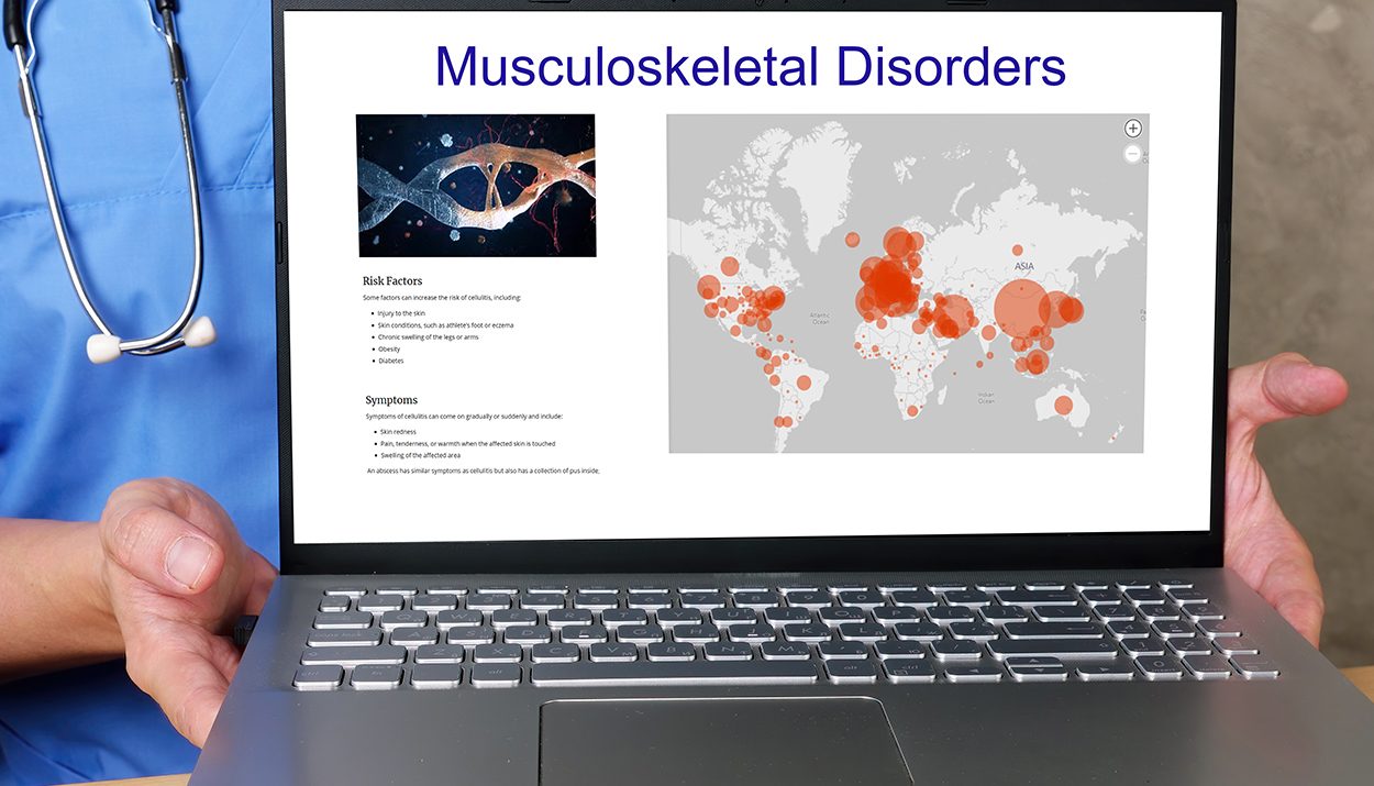 Minimizing Musculoskeletal Disorders