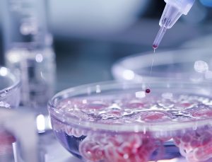 stem cell transplant