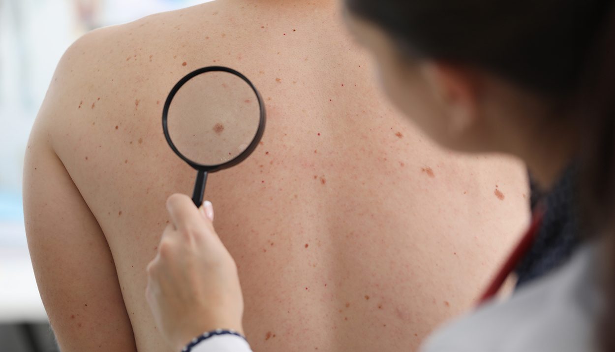 ILDS and Patient Advocacy Groups