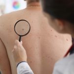 ILDS and Patient Advocacy Groups