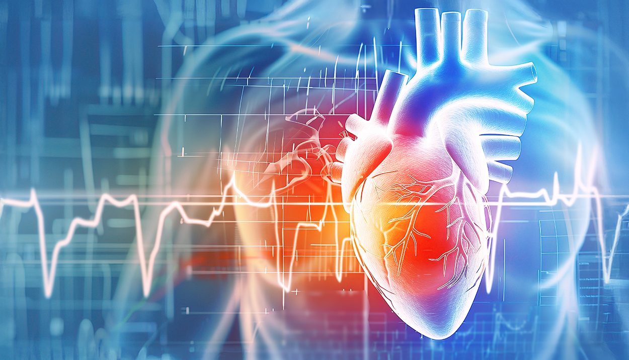 Long Qt Syndrome