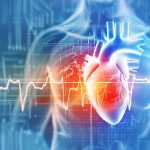 Long Qt Syndrome
