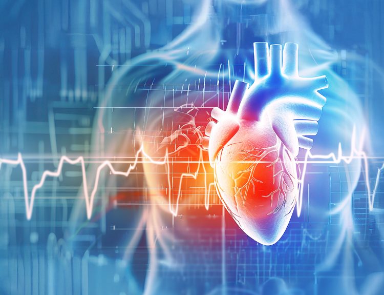 Long Qt Syndrome