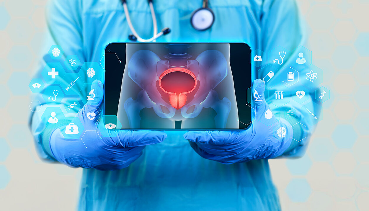 AI for Prostate Cancer Treatment