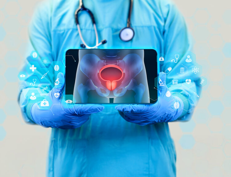 AI for Prostate Cancer Treatment