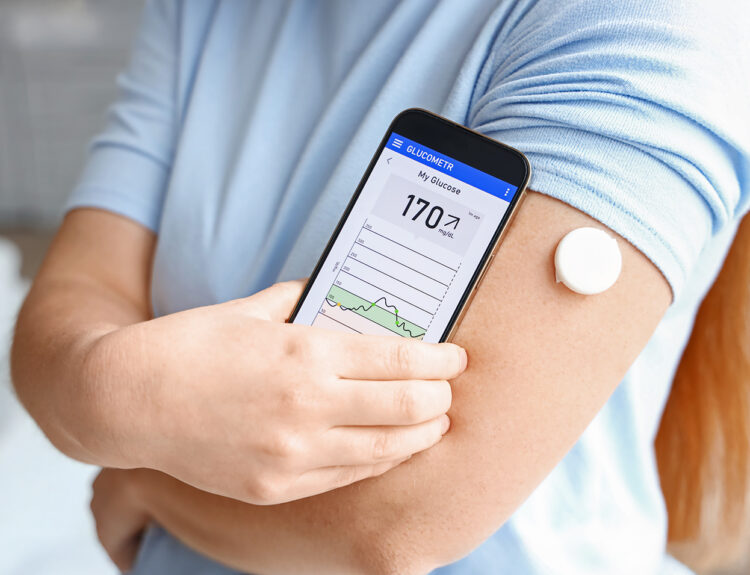 Insulin vs. CGM